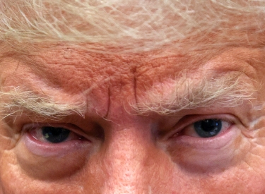Die Augenpartie des Donald Trump